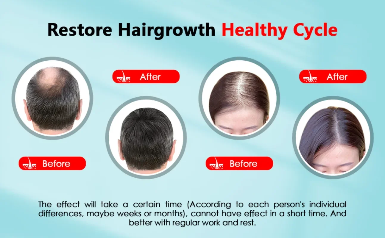 Bonnet de croissance des cheve - Hair Care With Protein avis et prix