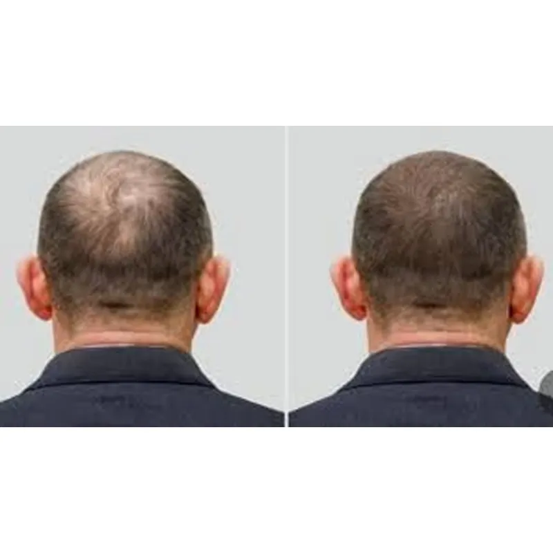 Casquette d'ozonothérapie Good - Hair Care Good Hair avis et prix